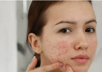 Skin Care