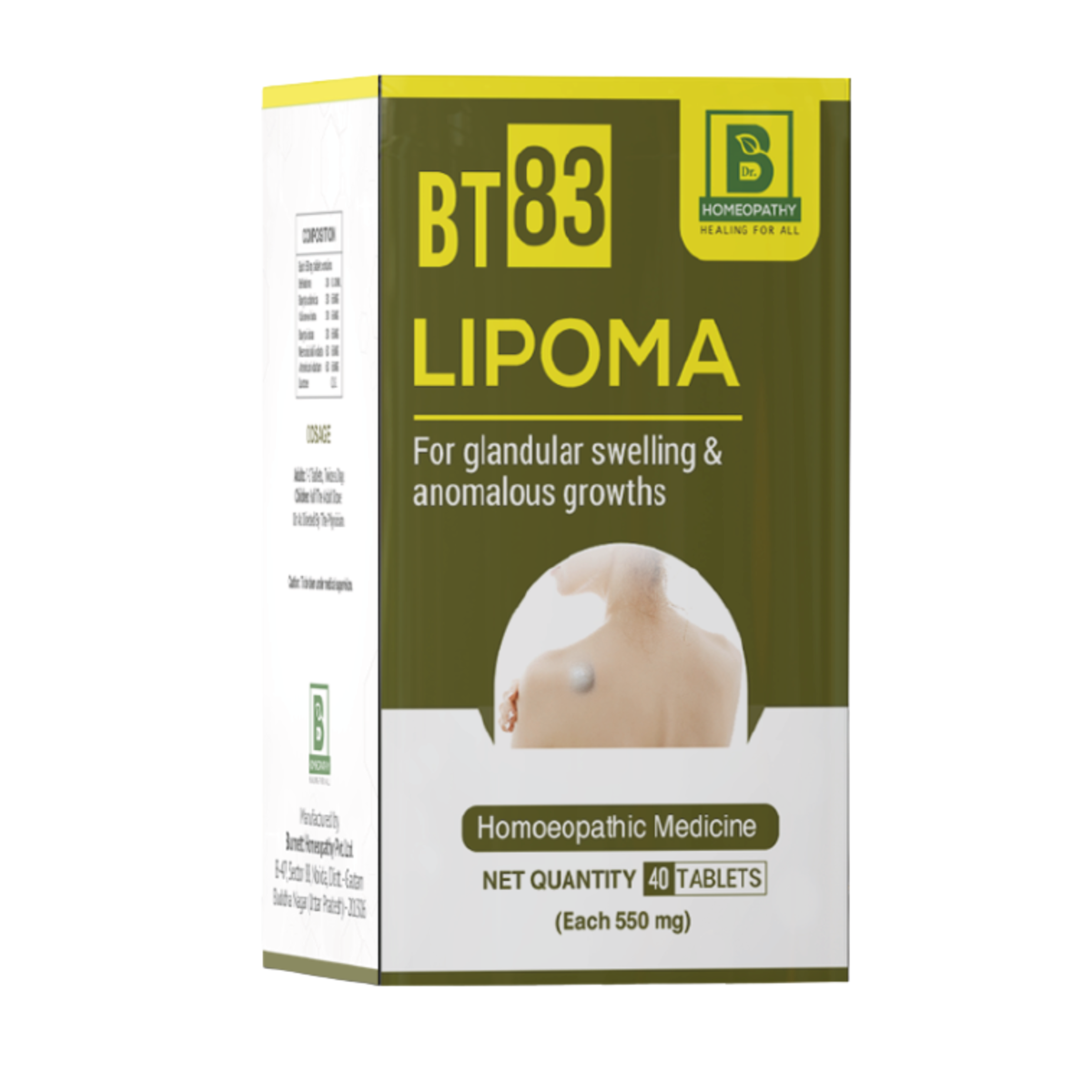 BT-83 Lipoma