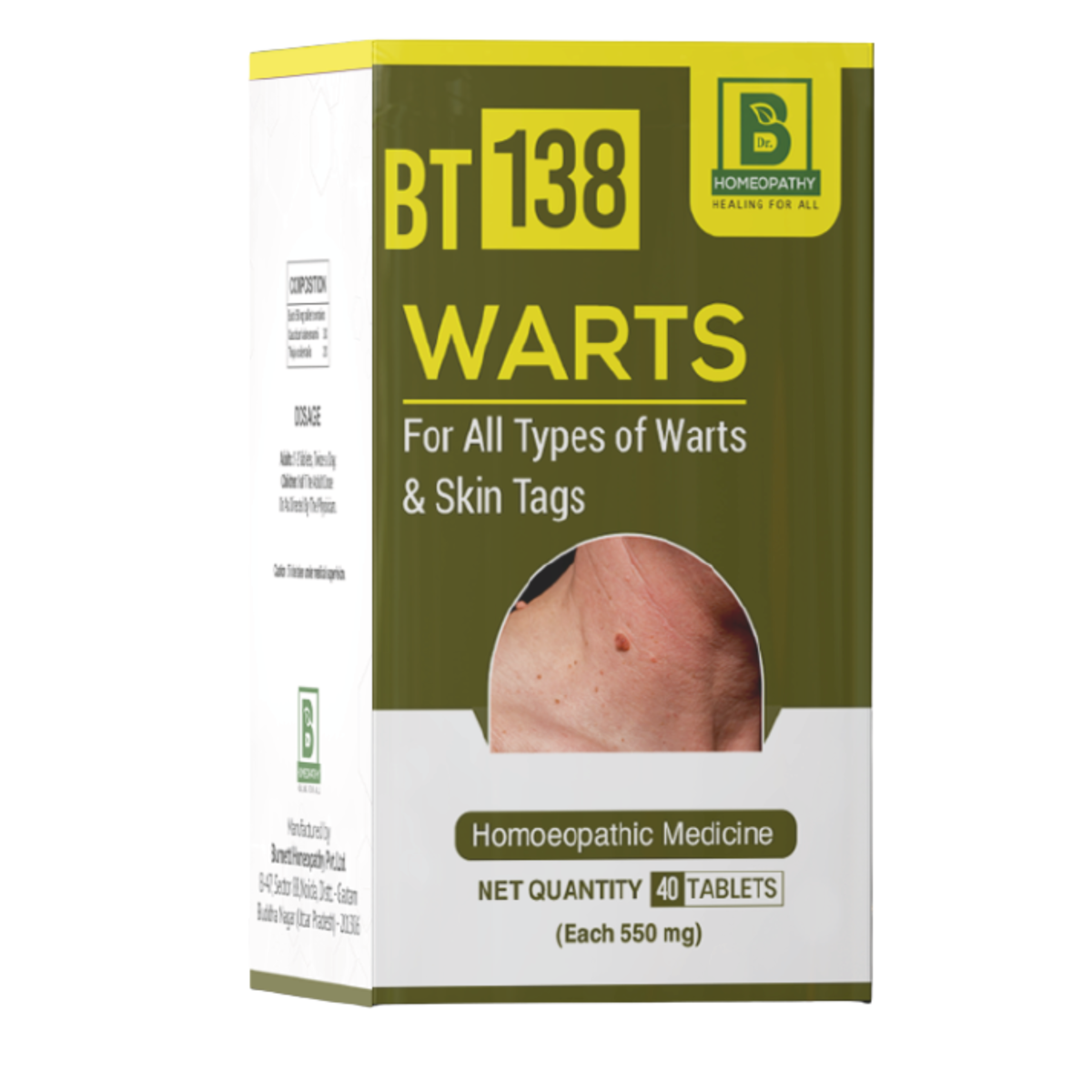 BT-138 Warts
